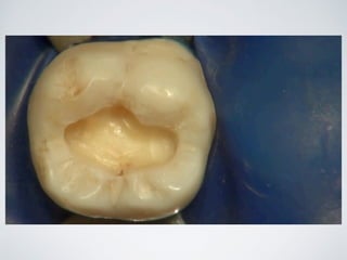 Nicolás Pérez Quiroz
Cirujano Dentista
 