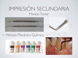 Nicolás Pérez Quiroz
Cirujano Dentista
IMPRESIÓN SECUNDARIA
• Método Mecánico-Químico
ManejoTisular
ManejoTisular
 