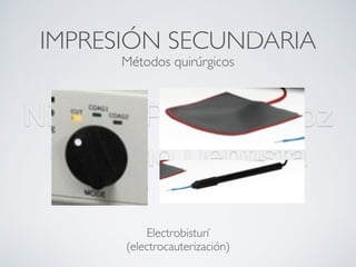 Nicolás Pérez Quiroz
Cirujano Dentista
IMPRESIÓN SECUNDARIA
ManejoTisular
Electrobisturí
(electrocauterización)
Métodos quirúrgicos
 