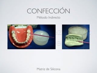 Nicolás Pérez Quiroz
Cirujano Dentista
CONFECCIÓN
Método Indirecto
Matriz de Silicona
 