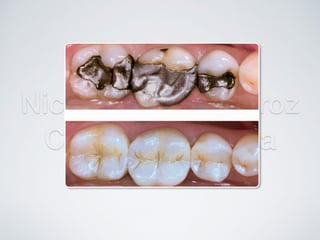 Nicolás Pérez Quiroz
Cirujano Dentista
 