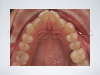 Nicolás Pérez Quiroz
Cirujano Dentista
 