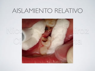 Nicolás Pérez Quiroz
Cirujano Dentista
AISLAMIENTO RELATIVO
 