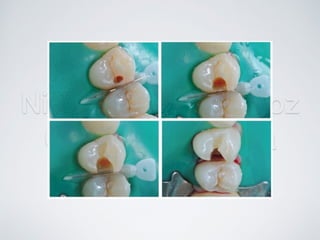 Nicolás Pérez Quiroz
Cirujano Dentista
 