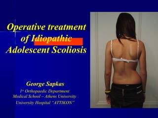 Operative treatment 
of Idiopathic 
Adolescent Scoliosis 
George Sapkas 
1st Orthopaedic Department 
Medical School – Athens University 
University Hospital “ATTIKON” 
 