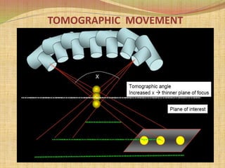 TOMOGRAPHIC MOVEMENT
 