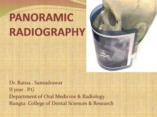 Dr. Ratna . Samudrawar
II year . P.G
Department of Oral Medicine & Radiology
Rungta College of Dental Sciences & Research
 