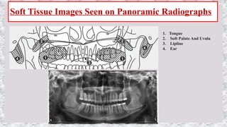 Perfect Pan Radiograph OPG (ORTHOPANTOMOGRAPHY) - PANORAMIC RADIOGRAPHY- DR PRIYANKA | PPTX