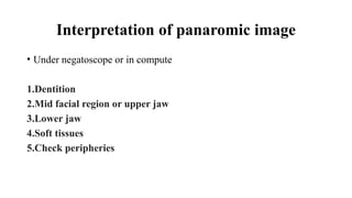 Interpretation of panaromic image
• Under negatoscope or in compute
1.Dentition
2.Mid facial region or upper jaw
3.Lower jaw
4.Soft tissues
5.Check peripheries
 