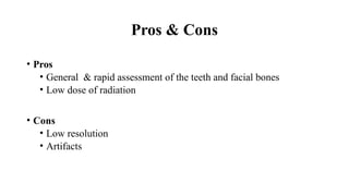 Pros & Cons
• Pros
• General & rapid assessment of the teeth and facial bones
• Low dose of radiation
• Cons
• Low resolution
• Artifacts
 