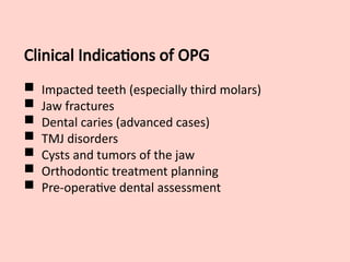 Clinical Indications of OPG
 Impacted teeth (especially third molars)
 Jaw fractures
 Dental caries (advanced cases)
 TMJ disorders
 Cysts and tumors of the jaw
 Orthodontic treatment planning
 Pre-operative dental assessment
 
