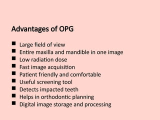 Advantages of OPG
 Large field of view
 Entire maxilla and mandible in one image
 Low radiation dose
 Fast image acquisition
 Patient friendly and comfortable
 Useful screening tool
 Detects impacted teeth
 Helps in orthodontic planning
 Digital image storage and processing
 
