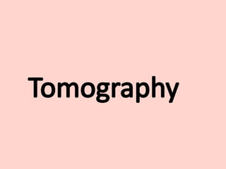 Tomography
 