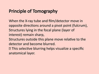 Principle of Tomography
When the X-ray tube and film/detector move in
opposite directions around a pivot point (fulcrum),
Structures lying in the focal plane (layer of
interest) remain sharp,
Structures outside this plane move relative to the
detector and become blurred.
📌 This selective blurring helps visualize a specific
anatomical layer.
 