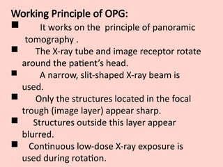 Working Principle of OPG:
 It works on the principle of panoramic
tomography .
 The X-ray tube and image receptor rotate
around the patient’s head.
 A narrow, slit-shaped X-ray beam is
used.
 Only the structures located in the focal
trough (image layer) appear sharp.
 Structures outside this layer appear
blurred.
 Continuous low-dose X-ray exposure is
used during rotation.
 