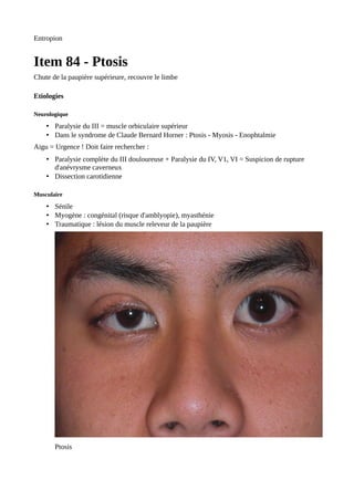 Entropion
Item 84 - Ptosis
Chute de la paupière supérieure, recouvre le limbe
Etiologies
Neurologique
• Paralysie du III = muscle orbiculaire supérieur
• Dans le syndrome de Claude Bernard Horner : Ptosis - Myosis - Enophtalmie
Aigu = Urgence ! Doit faire rechercher :
• Paralysie complète du III douloureuse + Paralysie du IV, V1, VI = Suspicion de rupture
d'anévrysme caverneux
• Dissection carotidienne
Musculaire
• Sénile
• Myogène : congénital (risque d'amblyopie), myasthénie
• Traumatique : lésion du muscle releveur de la paupière
Ptosis
 
