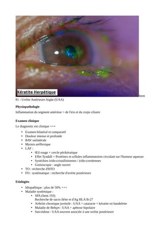 Item
81 - Uvéite Antérieure Aigüe (UAA)
Physiopathologie
Inflammation du segment antérieur = de l'iris et du corps ciliaire
Examen clinique
Le diagnostic est clinique +++
• Examen bilatéral et comparatif
• Douleur intense et profonde
• BAV unilatérale
• Myosis aréflexique
• LAF :
• Œil rouge + cercle périkératique
• Effet Tyndall = Protéines et cellules inflammatoires circulant sur l'humeur aqueuse
• Synéchies irido-cristalliniennes / irido-cornéennes
• Gonioscopie : angle ouvert
• TO : recherche d'HTO
• FO : systématique : recherche d'uvéite postérieure
Etiologies
• Idiopathique : plus de 50% +++
• Maladie systémique :
• SPA (Item 193)
Recherche de sacro iléite et d'Ag HLA B-27
• Arthrite chronique juvénile : UAA + cataracte + kératite en bandelette
• Maladie de Behçet : UAA + aphtose bipolaire
• Sarcoïdose : UAA souvent associée à une uvéite postérieure
 