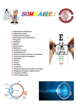 SOMMAIRE :
1- Conjonctivites bactérienne ;
2- Conjonctivite virale ;
3- Conjonctivite allergique ;
4- Hémorragie sous-conjonctivale ;
5- Ptérygion ;
6- Chalazion ;
7- Orgelet ;
8- Dacryocystite ;
9- Blépharite ;
10- Erosion de cornée ;
11- Ophtalmie de UV ;
12- Brulure occulaire chimique et thermique ;
13- Brulure par gaz lacrymogène ;
14- Episclérite ;
15- Sclérite ;
16- Uvéite ;
17- Kératite ;
18- Trachome ;
19- Glaucome aigue par fermetture de l’angle ;
20- Glaugome chronique à angle ouverte,
21- Contusion et Plaies ;
22- Œil et médicaments.
 