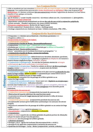 clinique
# Elle se manifeste par une sensation
bilatérale . Les conjonctivites peuvent être
douloureuses. # L'atteinte cornéenne
visuelle si l'axe optique est touché.
1- interrogatoire:
-pas de douleur ;/- acuité visuelle conservée/
2- Examen à la lampe à fente:LAF
- Hyperhémie conjonctivale prédominant au niveau
- Cornée normale, - Chambre antérieure, iris, tonus oculaire normaux.
3) Examens complémentaires : Recherche de l’agent causal
 Frottis conjonctival : Examen direct ; Culture ; Antibiogramme
 Grattage conjonctival avec étalement sur lame : Cellules à inclusions ; PNE ; PNN
Conjonctivite bactérienne
clinique
# Fréquentes ++/ Atteinte uni ou bilatérale
 Paupières collées +++
A.Conjonctivites de l’adulte et de l’enfant
1. Conjonctivites catarrhales :
 Conjonctivite à bacille de Weeks : (heamophilusinfluenzae
# conjonctivite catarrhale aigue ‘’ / Bilatérales et très contagieuses
 Evolution par épidémie saisonnières
Afrique du Nord - Bassin méditerranéen
 Grave ‘’ association avec le trachome favorisant sa propagation ‘’ ++
 Conjonctivite à bacille de Morax : vecteur du trachome.
2. Conjonctivites purulentes :
 Conjonctivite à pneumocoque :Début brutal avec Sécrétion abondante, purulente
 Conjonctivite à staphylocoque : Complique en général
d’autres lésions staphylococciques : Furoncle ; Orgelet
 Conjonctivite à méningocoque : Se voit chez les patients atteints de
cérébrospinale ou d’autres pathologies à méningocoque
 Conjonctivite à streptocoque :Touche les enfants au décours
éruptive comme la rougeole ou la scarlatine
pseudomembraneuses ;
 Conjonctivite à gonocoque :la contamination est le plus souvent
mains ou linge souillés. Adulte et enfant
malade (mains souillées) ou par le linge souillé
- Le nouveau-né contaminé lors du passage de la filière génitale ou au
contact du linge souillé.
 Conjonctivite pseudomembraneuse :
 Conjonctivite folliculaire : folliculose infantile :
survient chez l’enfant avec végétations adénoides
cavum, ADP cervicales et médiastinales
traitement.
B. Conjonctivite du nouveau né :
 Conjonction à pneumocoque(conjonctivite lacrymale du nouveau
 Obstruction de la partie inférieure du canal lacrymo
 La pression au niveau de l’angle interne de l’œil
contenant du pus.
 Conjonctivite gonococcique : (conjonctivite purulente du nouveau né)
 Exceptionnelle surtout après l’infiltration systématique à la naissance de nitrate
d’argent,
 Nouveau né contaminé lors du passage de
souillé ;
 Début précoce 3-5 jour après la naissance +++
C. Cas particulier : conjonctivite à chlamydia trachomatis
 transmission :
 adulte et enfant :à partir des secrétions génitales du patient porteur
soit par les mains soit par l’eau des piscines
 nouveau né : lors du passage de la filière génitale.
 plusieurs sérotypes :
 sérotype .A ;B ;C : agents du trachome (kératoconjonctivite
 sérotype D à K :agent des conjonctivite
 Syndrome de Fiessinger – Leroy – Reïter (conjonctivite ; urétrite, arthrite)
Les Conjonctivite
Elle se manifeste par une sensation de grains de sable, de corps étranger, un prurit
vent être virales, bactériennes ou allergiques. Elles sont en général
L'atteinte cornéenne (kératoconjonctivite) entraîne l'apparition de douleurs et d'une baiss
acuité visuelle conservée/ -sécrétions collant aux cils ;/ Larmoiement
ivale prédominant au niveau des culs-de-sacs et de la conjonctive palpébrale.
Chambre antérieure, iris, tonus oculaire normaux.
Recherche de l’agent causal
Frottis conjonctival : Examen direct ; Culture ; Antibiogramme
Grattage conjonctival avec étalement sur lame : Cellules à inclusions ; PNE ; PNN…
Conjonctivite bactérienne
Atteinte uni ou bilatérale ;/ Sécrétions purulentes +++
Conjonctivites de l’adulte et de l’enfant :
(heamophilusinfluenzae) :
Bilatérales et très contagieuses ;
épidémie saisonnières,  Favorisés par la chaleur et l’humidité ‘’
Bassin méditerranéen » ;
Grave ‘’ association avec le trachome favorisant sa propagation ‘’ ++
Conjonctivite à bacille de Morax : vecteur du trachome.
:Début brutal avec Sécrétion abondante, purulente
Complique en général une blépharite et s’associe à
Furoncle ; Orgelet.
Se voit chez les patients atteints de méningite
d’autres pathologies à méningocoque.
Touche les enfants au décours de fièvre prolongée
la rougeole ou la scarlatine ; et peut avoir des formes
la contamination est le plus souvent accidentelle Par des
Adulte et enfant se contaminent par contact direct avec le
souillées) ou par le linge souillé
passage de la filière génitale ou au
Conjonctivite pseudomembraneuse : Grave mais rare ; Diphtérie ou streptocoque
folliculose infantile :
végétations adénoides , grosses amygdales, infection du
et médiastinales. Non contagieuse et ne nécessite pas de
(conjonctivite lacrymale du nouveau-né) :
Obstruction de la partie inférieure du canal lacrymo-nasal ;
l’angle interne de l’œil entraine le reflux de larmes
(conjonctivite purulente du nouveau né)
Exceptionnelle surtout après l’infiltration systématique à la naissance de nitrate
Nouveau né contaminé lors du passage de la filière génitale ou au contact de linge
après la naissance +++.
chlamydia trachomatis.
:à partir des secrétions génitales du patient porteur de chlamydia
soit par l’eau des piscines ;
: lors du passage de la filière génitale.
sérotype .A ;B ;C : agents du trachome (kératoconjonctivite cécité ) ;
sérotype D à K :agent des conjonctivites à inclusion du nouveau né.
Reïter (conjonctivite ; urétrite, arthrite) ;
un prurit ; elle peut être uni- ou
. Elles sont en général non
entraîne l'apparition de douleurs et d'une baisse
Larmoiement +/- photophobie ;
sacs et de la conjonctive palpébrale.
:Début brutal avec Sécrétion abondante, purulente,
et s’associe à
accidentelle Par des
streptocoque ;
de chlamydia
Figure 1 : conjoctivite à
gonocoque
Figure 2
pseudomembraneuse
diphtérique
Figure 3 folliculaire
« trachome »
 