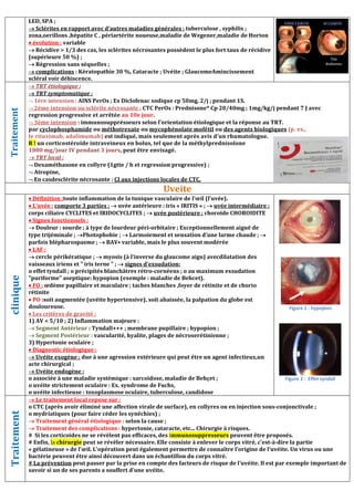 LED, SPA ;
 Sclérites en rapport avec d’autres maladies générales : tuberculose , syphilis ;
zona,oerillons ,hépatite C , périartérite noueuse,maladie de Wegener,maladie de Horton
 évolution : variable
 Récidive  1/3 des cas, les sclérites nécrosantes possèdent le plus fort taux de récidive
(supérieure 50 %) ;
 Régression sans séquelles ;
 complications : Kératopathie 30 %, Cataracte ; Uvéite ; GlaucomeAmincissement
scléral voir déhiscence.
Traitement
 TRT étiologique ;
 TRT symptomatique :
 1ère intension : AINS PerOs ; Ex Diclofenac sodique cp 50mg, 2/j ; pendant 1S.
 2ème intension ou sclérite nécrosante : CTC PerOs : Prednisone* Cp 20/40mg ; 1mg/kg/j pendant 7 J avec
regression progressive et arrêtée au 10e jour.
 3ème intension : immunosupprésseurs selon l’orientation étiologique et la réponse au TRT.
par cyclophosphamide ou méthotrexate ou mycophénolate mofétil ou des agents biologiques (p. ex.,
le rituximab, adalimumab) est indiqué, mais seulement après avis d'un rhumatologue.
R ! un corticostéroïde intraveineux en bolus, tel que de la méthylprednisolone
1000 mg/jour IV pendant 3 jours, peut être envisagé.
 TRT local :
 Dexaméthasone en collyre (1gtte / h et regression progressive) ;
 Atropine,
 En casdesclérite nécrosante : CI aux injections locales de CTC,
Uveite
clinique
 Définition :toute inflammation de la tunique vasculaire de l’œil (l’uvée).
 L’uvée : comporte 3 parties :  uvée antérieure : iris « IRITIS » ;  uvée intermédiaire :
corps ciliaire CYCLITES et IRIDOCYCLITES ;  uvée postérieure : choroïde CHOROIDITE
 Signes fonctionnels :
 Douleur : sourde ; à type de lourdeur péri-orbitaire ; Exceptionnellement aiguë de
type trijéminale ; Photophobie ;  Larmoiement et sensation d’une larme chaude ; 
parfois blépharospasme ;  BAV• variable, mais le plus souvent modérée
 LAF :
 cercle périkératique ;  myosis (à l’inverse du glaucome aigu) avecdilatation des
vaisseaux iriens et  iris terne  ;  signes d'exsudation:
o effet tyndall ; o précipités blanchâtres rétro-cornéens ; o au maximum exsudation
puriforme aseptique: hypopion (exemple : maladie de Behcet).
 FO : œdème papillaire et maculaire ; taches blanches ,foyer de rétinite et de chorio
rétinite
 PO :soit augmentée (uvéite hypertensive), soit abaissée, la palpation du globe est
douloureuse.
 Les critères de gravité :
1) AV  5/10 ; 2) Inflammation majeure :
 Segment Antérieur : Tyndall+++ ; membrane pupillaire ; hypopion ;
 Segment Postérieur : vascularité, hyalite, plages de nécroserétinienne ;
3) Hypertonie oculaire ;
 Diagnostic étiologique :
 Uvéite exogène : due à une agression extérieure qui peut être un agent infectieux,un
acte chirurgical ;
 Uvéite endogène :
o associée à une maladie systémique : sarcoïdose, maladie de Behçet ;
o uvéite strictement oculaire : Ex. syndrome de Fuchs,
o uvéite infectieuse : toxoplasmose oculaire, tuberculose, candidose
Traitement
 Le traitement local repose sur :
o CTC (après avoir éliminé une affection virale de surface), en collyres ou en injection sous-conjonctivale ;
o mydriatiques (pour faire céder les synéchies) ;
 Traitement général étiologique : selon la cause ;
 Traitement des complications : hypertonie, cataracte, etc... Chirurgie à risques.
# Si les corticoïdes ne se révèlent pas efficaces, des immunosuppresseurs peuvent être proposés.
# Enfin, la chirurgie peut se révéler nécessaire. Elle consiste à enlever le corps vitré, c'est-à-dire la partie
« gélatineuse » de l’œil. L’opération peut également permettre de connaître l’origine de l’uvéite. Un virus ou une
bactérie peuvent être ainsi découvert dans un échantillon du corps vitré.
# La prévention peut passer par la prise en compte des facteurs de risque de l’uvéite. Il est par exemple important de
savoir si un de ses parents a souffert d’une uvéite.
Figure 1 : hypopion
Figure 2 : Effet tyndall
 