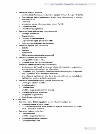 HORS PROGRAMME I SEMIOLOGIE EN OPHTALMOLOGIE
Examen de l'iris pour rechercher:
Une mydriase aréflexique, témoin d'une crise aiguë par fermeture de l'angle irido-cornéen
x Des synéchies irido-cristalliniennes, témoins d'une inflammation de la chambre
antérieure (Fig. 17)
x Un myosis
x Une rubéose irienne (néovascularisation irienne) (Fig. 18)
x Une hétérochromie
x Une iridotomie périphérique
Examen de l'angle irido-cornéen avec évaluation de:
x Son degré d'ouverture
x Sa pigmentation
x La présence de néovaisseaux
x La présence de dépôts pseudo-exfoliatifs
x La présence de synéchies irido-cornéennes
Examen de la pupille avec évaluation de:
x Sa taille
x Sa forme
x Son diamètre
x Réflexe photomoteur direct et consensuel
Examen du cristallin pour rechercher:
x Une opacité localisée ou diffuse
x Une subluxation (Fig. 19) ou une luxation
Examen de la chambre antérieure pour rechercher:
x Un phénomène de Tyndall (présence de cellules inflammatoires en suspension en
chambre antérieure témoignant d'une inflammation)
x Un hyphéma (Fig. 20) (présence de sang en chambre antérieure) ou d'un hypopion
(Fig. 21) (présence de pus en chambre antérieure)
x Une athalamie (aplatissement total de la chambre antérieure) ou hypothalamie
(aplatissement partiel de la chambre antérieure)
Examen de la conjonctive bulbaire et tarsale pour rechercher:
x Une rougeur localisée ou diffuse
x Une plaie oculaire
x Une tuméfaction
x Une hémorragie sous conjonctivale (Fig. 22)
x Un chémosis (œdème conjonctival)
x Des papilles conjonctivales
x Des follicules conjonctivaux
• Le fond d'œil:
Il est réalisé après dilatation pupillaire par des collyres mydriatiques par:
x Un ophtalmoscope direct ou indirect
x Ou un biomicroscope et d'une lentille non contact (lentille Volk®) ou contact
(verre à 3 miroirs de Goldmann)
Examen du vitré pour rechercher:
x Une inflammation
x Une hémorragie intra-vitréenne
x Une prolifération vitréo-rétinienne
x Un décollement du vitré
19
 