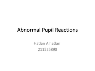 Abnormal Pupil Reactions
Hatlan Alhatlan
211525898
 