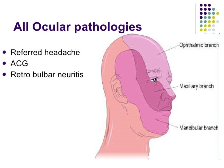 Ophthalmic Causes Of Headache
