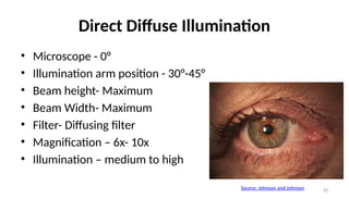 Ophthalmic Instrument (Slit lamp, Direct and Indirect Ophthalmoscope | PPTX