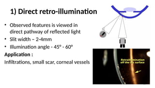 Ophthalmic Instrument (Slit lamp, Direct and Indirect Ophthalmoscope | PPTX