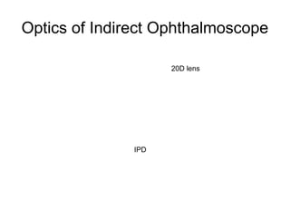 Optics of Indirect Ophthalmoscope
IPD
20D lens
 