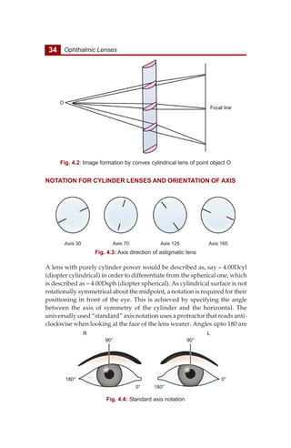 34 Ophthalmic Lenses
NOTATION FOR CYLINDER LENSES AND ORIENTATION OF AXIS
A lens with purely cylinder power would be described as, say – 4.00Dcyl
(diopter cylindrical) in order to differentiate from the spherical one, which
is described as – 4.00Dsph (diopter spherical). As cylindrical surface is not
rotationally symmetrical about the midpoint, a notation is required for their
positioning in front of the eye. This is achieved by specifying the angle
between the axis of symmetry of the cylinder and the horizontal. The
universally used “standard” axis notation uses a protractor that reads anti-
clockwise when looking at the face of the lens wearer. Angles upto 180 are
Fig. 4.3: Axis direction of astigmatic lens
Fig. 4.2: Image formation by convex cylindrical lens of point object O
Fig. 4.4: Standard axis notation
 