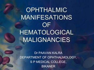OPHTHALMIC
MANIFESATIONS
      OF
HEMATOLOGICAL
 MALIGNANCIES
        Dr PAAVAN KALRA
DEPARTMENT OF OPHTHALMOLOGY,
     S P MEDICAL COLLEGE,
            BIKANER
 