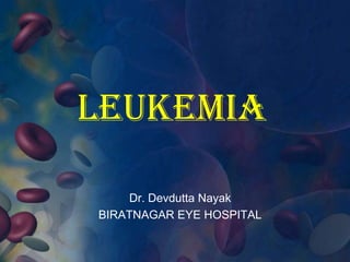 LEUKEMIA
Dr. Devdutta Nayak
BIRATNAGAR EYE HOSPITAL
 