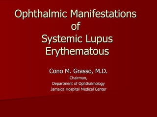 Ophthalmic Manifestations  of  Systemic Lupus Erythematous Cono M. Grasso, M.D. Chairman, Department of Ophthalmology Jamaica Hospital Medical Center 