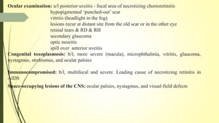 Ocular examination: u/l posterior uveitis - focal area of necrotizing chorioretinitis
hypopigmented ‘punched-out’ scar
vitritis (headlight in the fog)
lesions recur at distant site from the old scar or in the other eye
retinal tears & RD & RH
secondary glaucoma
optic neuritis
spill over anterior uveitis
Congenital toxoplasmosis: b/l, more severe (macula), microphthalmia, vitritis, glaucoma,
nystagmus, strabismus, and ocular palsies
Immunocompromised: b/l, multifocal and severe. Leading cause of necrotizing retinitis in
AIDS
Space-occupying lesions of the CNS: ocular palsies, nystagmus, and visual-field defects
 