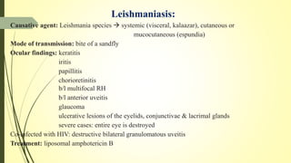 Leishmaniasis:
Causative agent: Leishmania species  systemic (visceral, kalaazar), cutaneous or
mucocutaneous (espundia)
Mode of transmission: bite of a sandfly
Ocular findings: keratitis
iritis
papillitis
chorioretinitis
b/l multifocal RH
b/l anterior uveitis
glaucoma
ulcerative lesions of the eyelids, conjunctivae & lacrimal glands
severe cases: entire eye is destroyed
Co-infected with HIV: destructive bilateral granulomatous uveitis
Treatment: liposomal amphotericin B
 