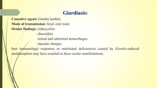 Giardiasis:
Causative agent: Giardia lamblia
Mode of transmission: fecal–oral route
Ocular findings: iridocyclitis
choroiditis
retinal and subretinal hemorrhages
macular changes
host immunologic responses or nutritional deficiencies caused by Giardia-induced
malabsorption may have resulted in these ocular manifestations.
 