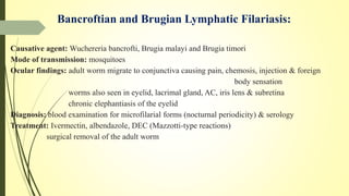 Bancroftian and Brugian Lymphatic Filariasis:
Causative agent: Wuchereria bancrofti, Brugia malayi and Brugia timori
Mode of transmission: mosquitoes
Ocular findings: adult worm migrate to conjunctiva causing pain, chemosis, injection & foreign
body sensation
worms also seen in eyelid, lacrimal gland, AC, iris lens & subretina
chronic elephantiasis of the eyelid
Diagnosis: blood examination for microfilarial forms (nocturnal periodicity) & serology
Treatment: Ivermectin, albendazole, DEC (Mazzotti-type reactions)
surgical removal of the adult worm
 