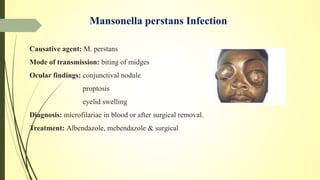 Mansonella perstans Infection
Causative agent: M. perstans
Mode of transmission: biting of midges
Ocular findings: conjunctival nodule
proptosis
eyelid swelling
Diagnosis: microfilariae in blood or after surgical removal.
Treatment: Albendazole, mebendazole & surgical
 