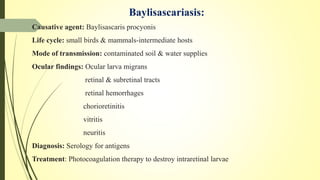 Baylisascariasis:
Causative agent: Baylisascaris procyonis
Life cycle: small birds & mammals-intermediate hosts
Mode of transmission: contaminated soil & water supplies
Ocular findings: Ocular larva migrans
retinal & subretinal tracts
retinal hemorrhages
chorioretinitis
vitritis
neuritis
Diagnosis: Serology for antigens
Treatment: Photocoagulation therapy to destroy intraretinal larvae
 