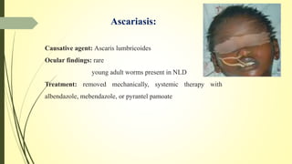 Ascariasis:
Causative agent: Ascaris lumbricoides
Ocular findings: rare
young adult worms present in NLD
Treatment: removed mechanically, systemic therapy with
albendazole, mebendazole, or pyrantel pamoate
 