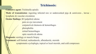 Trichinosis:
Causative agent: Trichinella spiralis
Mode of transmission: ingesting infected raw or undercooked pigs & carnivores , larvae -
lymphatic & vascular circulation
Ocular findings: B/l palpebral edema
pain on eye movement
conjunctival chemosis & hemorrhages
photophobia
retinal hemorrhages
optic neuritis & edema
Diagnosis: serology or muscle biopsy
Treatment: self-limited, mebendazole, albendazole, steroids
symptomatic-cycloplegia, topical or local steroids, and cold compresses
 
