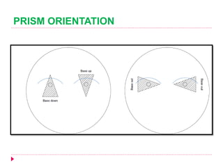 Prism In Optometry Ophthalmic prisms | PPTX