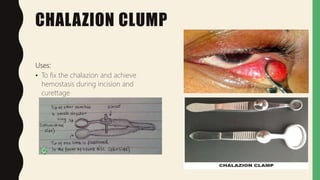 CHALAZION CLUMP
Uses:
• To fix the chalazion and achieve
hemostasis during incision and
curettage
 