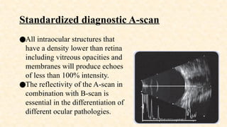 Ophthalmic Ultrasonography: How to Perform and Interpret | PPTX