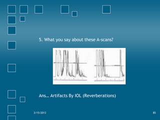 5. What you say about these A-scans?




   Ans… Artifacts By IOL (Reverberations)


3/15/2013                            ...