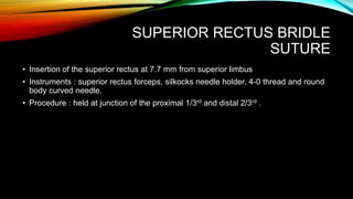 SUPERIOR RECTUS BRIDLE
SUTURE
• Insertion of the superior rectus at 7.7 mm from superior limbus
• Instruments : superior rectus forceps, silkocks needle holder, 4-0 thread and round
body curved needle.
• Procedure : held at junction of the proximal 1/3rd and distal 2/3rd .
 