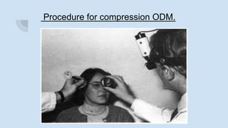 Procedure for compression ODM.
 