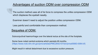 Advantages of suction ODM over compression ODM
The suction method uses all of its force to compress the unlike compression ODM
which displaces the eyeball nasally.
Examiner doesn’t need to adjust the position unlike compression ODM.
Less painful and comfortable than compression method.
Sequelea of ODM:
Subconjuctival haemorrhage over the lateral rectus at the site of the footplate.
Some have noted central scotoma which persists till months.
(https://www.ncbi.nlm.nih.gov/pmc/articles/PMC2642107/bin/jnma00683-0064.tif)
Might result in retinal detachment due to excessive suction pressure.
 
