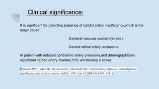 Clinical significance:
It is significant for detecting presence of carotid artery insufficiency,which is the
major cause :
Cerebral vascular accident(stroke).
Central retinal artery occlusions.
In patient with reduced ophthalmic artery pressures,and arteriographically
significant carotid artery disease,16% will develop a stroke.
(Busuttil RW, Baker JD, Davidson RK, Machleder HI. Carotid artery stenosis - hemodynamic
significance and clinical course. JAMA. 1981 Apr 10;245(14):1438–1441)
 
